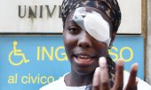 Injured athlete Daisy Osakue (© picture-alliance/dpa)