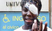 Injured athlete Daisy Osakue (© picture-alliance/dpa)